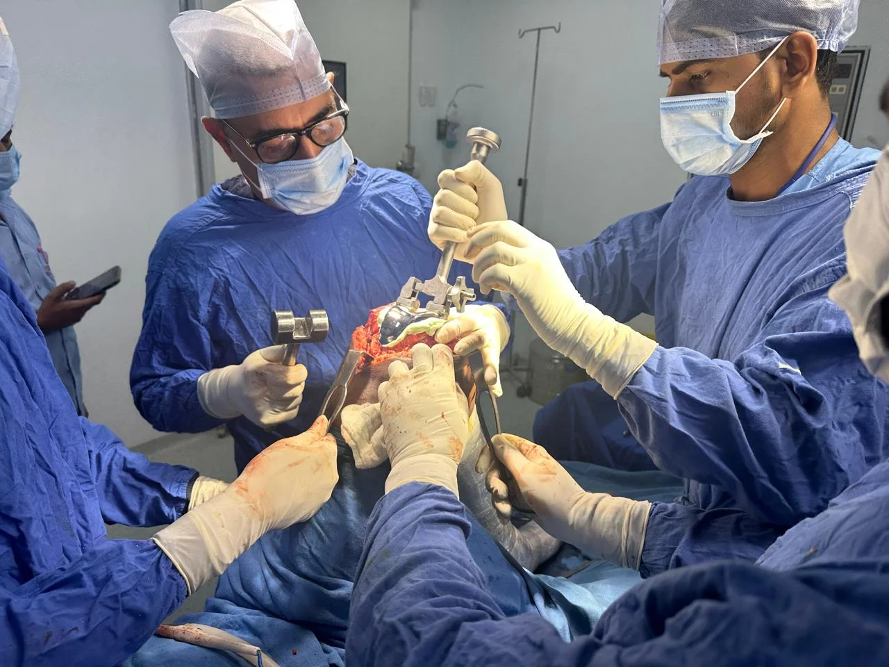 knee-implant-prosthesis